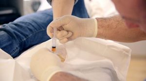 Patient getting PRP Injection