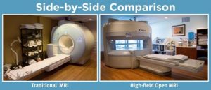 Traditional MRI vs High-field Open MRI
