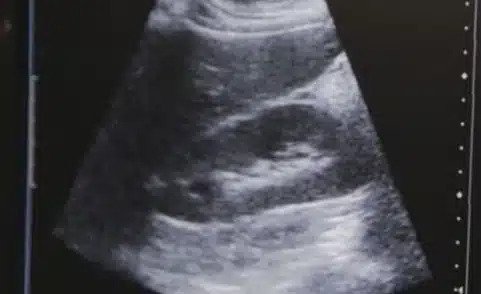 Three of the Most Common Ultrasound Exams